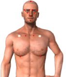 EFT-soigner les émotions EFT pour soigner les émotions